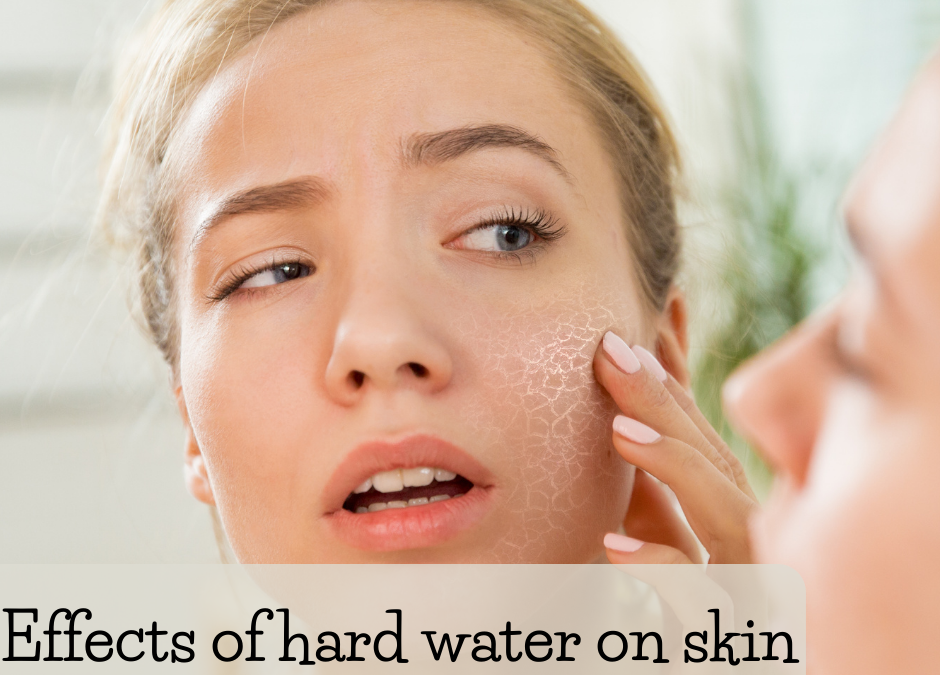 Why Is Hard Water On Skin a Problem?