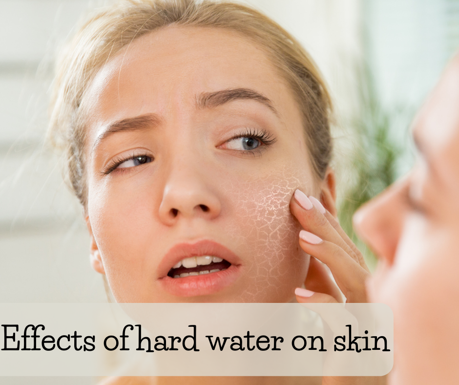 effects of hard water on skin